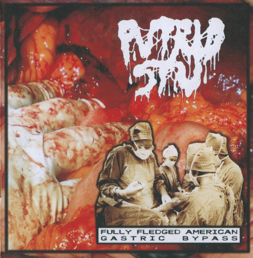 Putrid Stu : Fully Fledged American Gastric Bypass